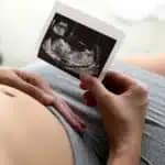 échographie grossesse tenue dans la main d’une femme