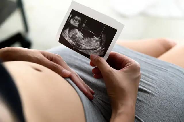 échographie grossesse tenue dans la main d’une femme