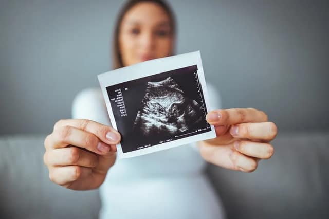 Foetus mois par mois avec femme enceinte tenant une échographie du bébé