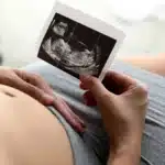 Main de femme qui tient une échographie dans sa main